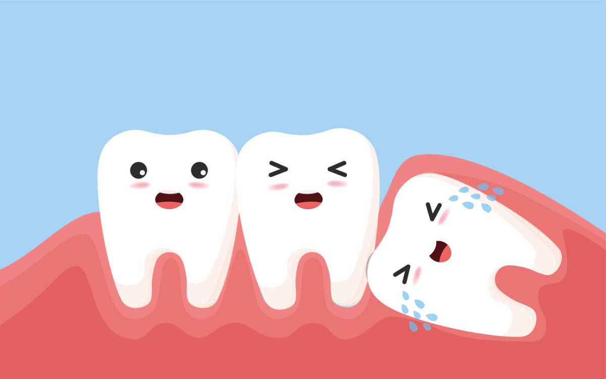 Best Age for Wisdom Teeth Removal | The Smile Specialists - Blog